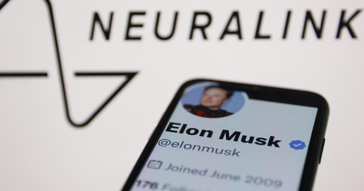 According to Elon Musk, the initial recipient of Neuralink technology has the ability to control a computer mouse using their thoughts.