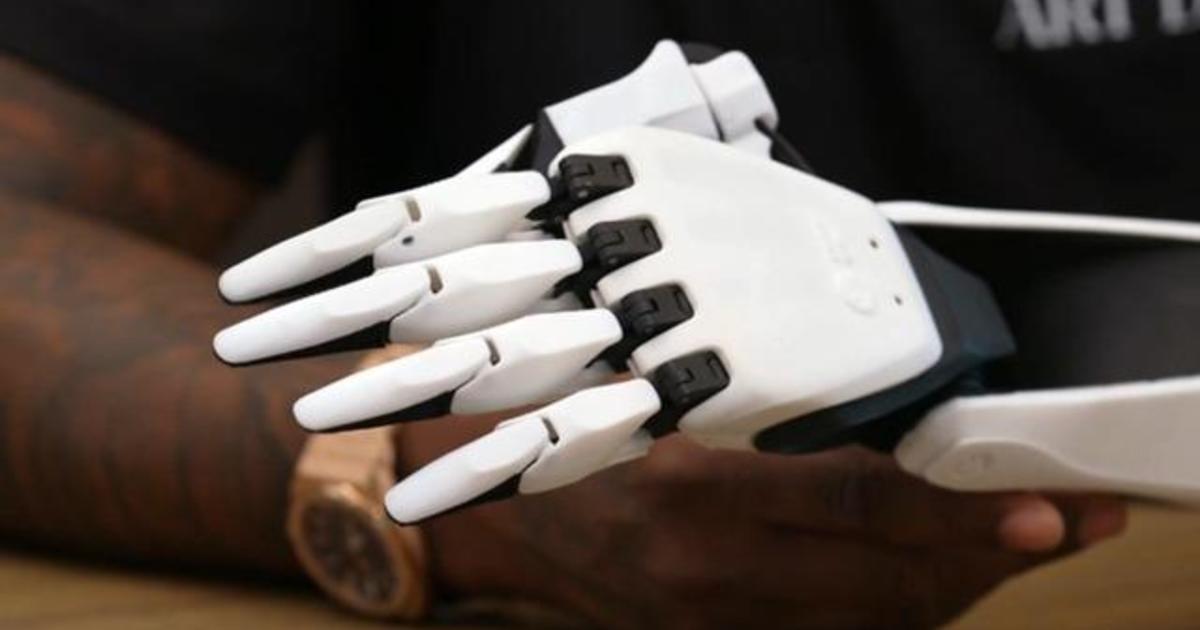 The goal of the AI-enhanced prosthetic arm is to revolutionize accessibility.