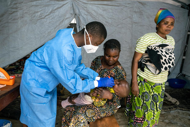 Congo gets first desperately needed mpox vaccines, but vaccination campaign faces huge challenges